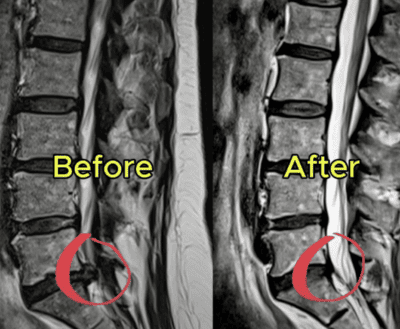 MRI ()