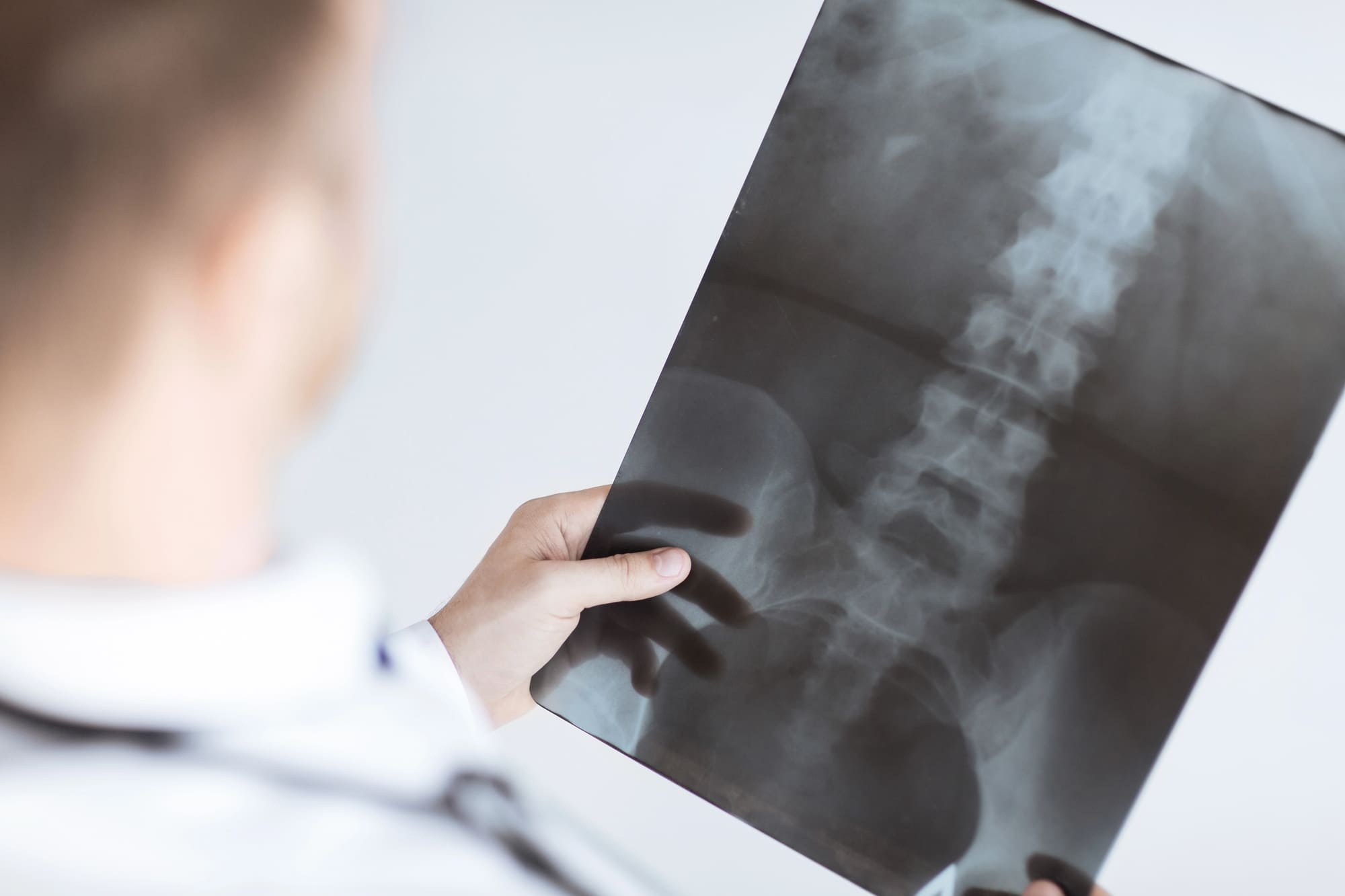 Spinewell disc and joint centers xray